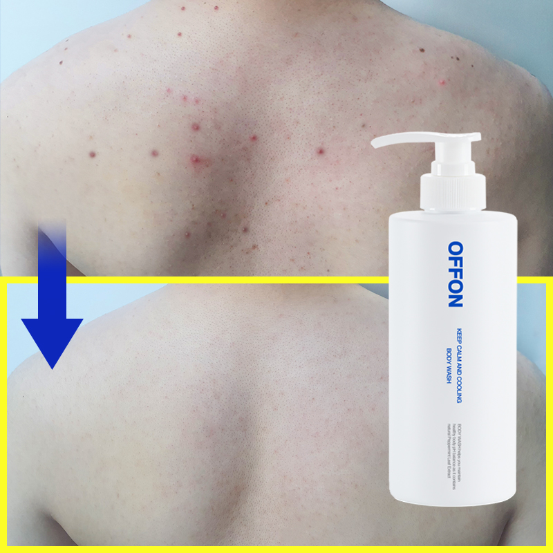 오프온 등드름 보습 바디워시 천연 퍼퓸 등여드름 가드름 남자여자 체취오래가는 비건클렌져1개