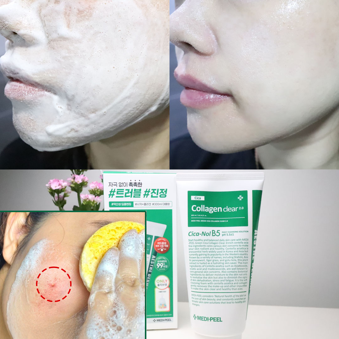 대용량 좁쌀 여드름 올리브영 약산성 클렌징폼 클렌저 판테놀 청소년 살리실산 폼클렌징 시카