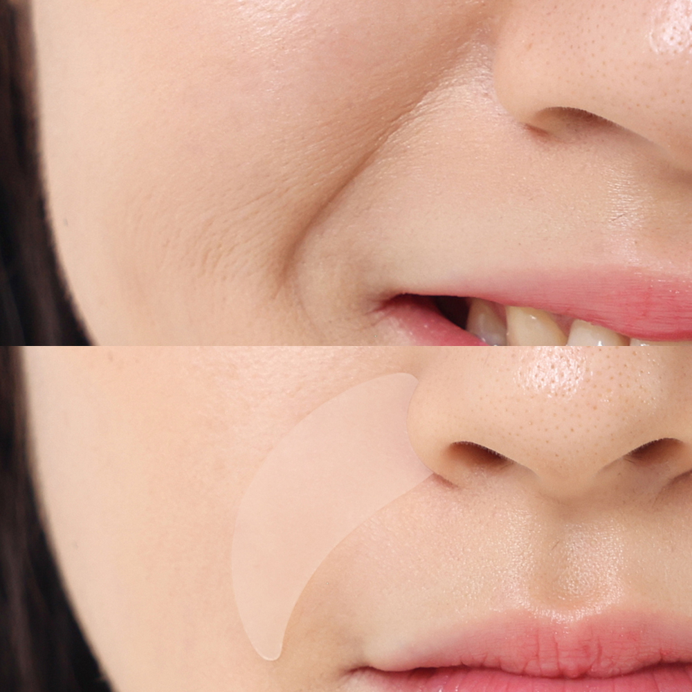 매드포코스 팔자주름패치 2매(72패치)/ 지퍼타입