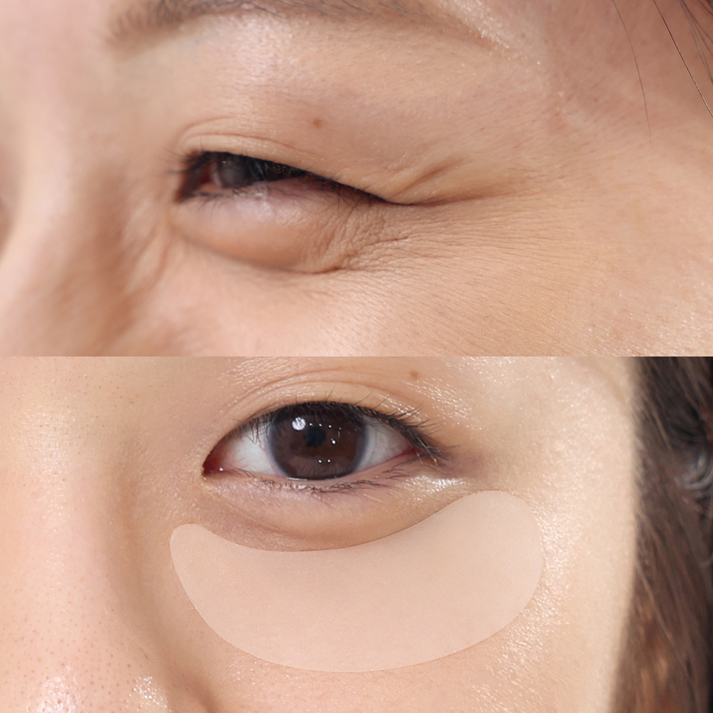 매드포코스 팔자주름패치 2매(72패치)/ 지퍼타입