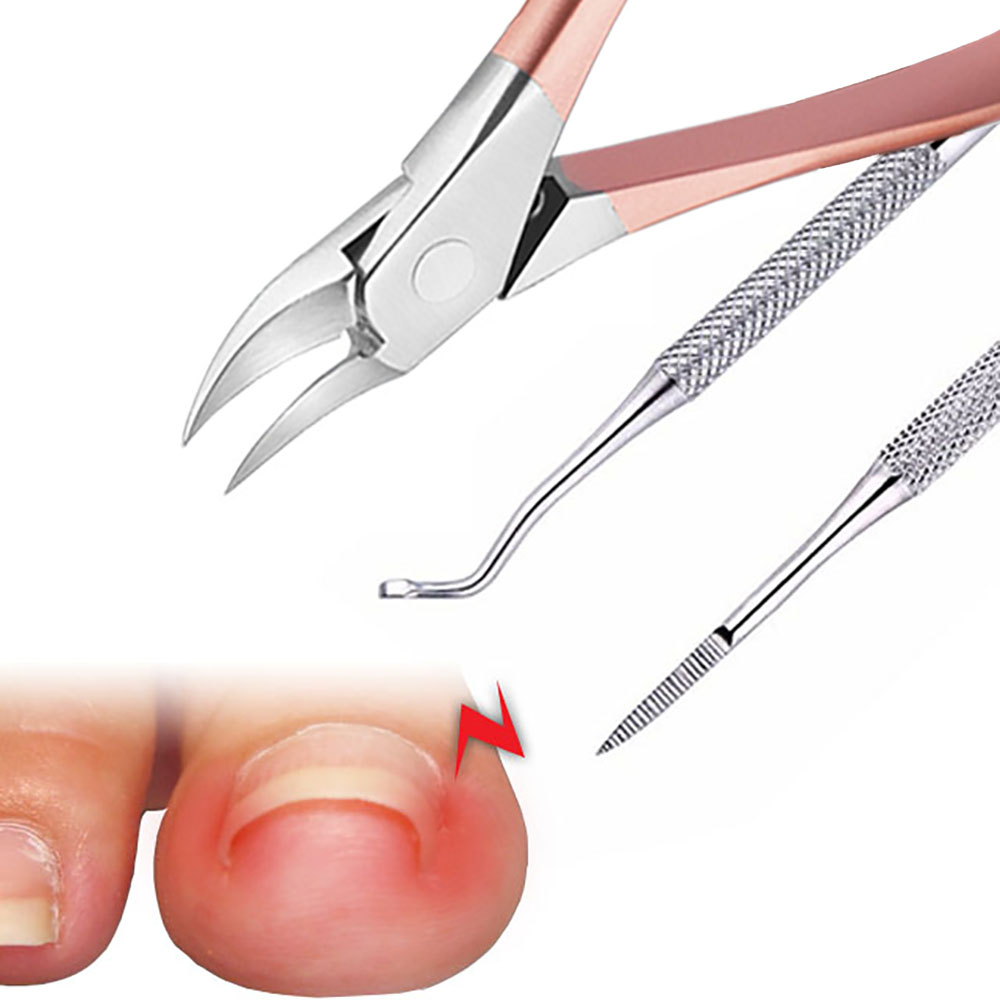두꺼운 내성발톱자가치료 손톱깍이 고급네일니퍼 3종세트 큐티클제거 큐렛 정리관리 무좀자르기